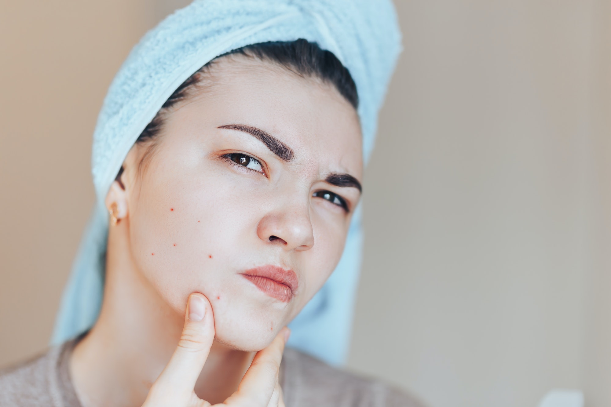 Scowling girl in shock of her acne with a towel on her head. Woman skin care concept photos of ugly
